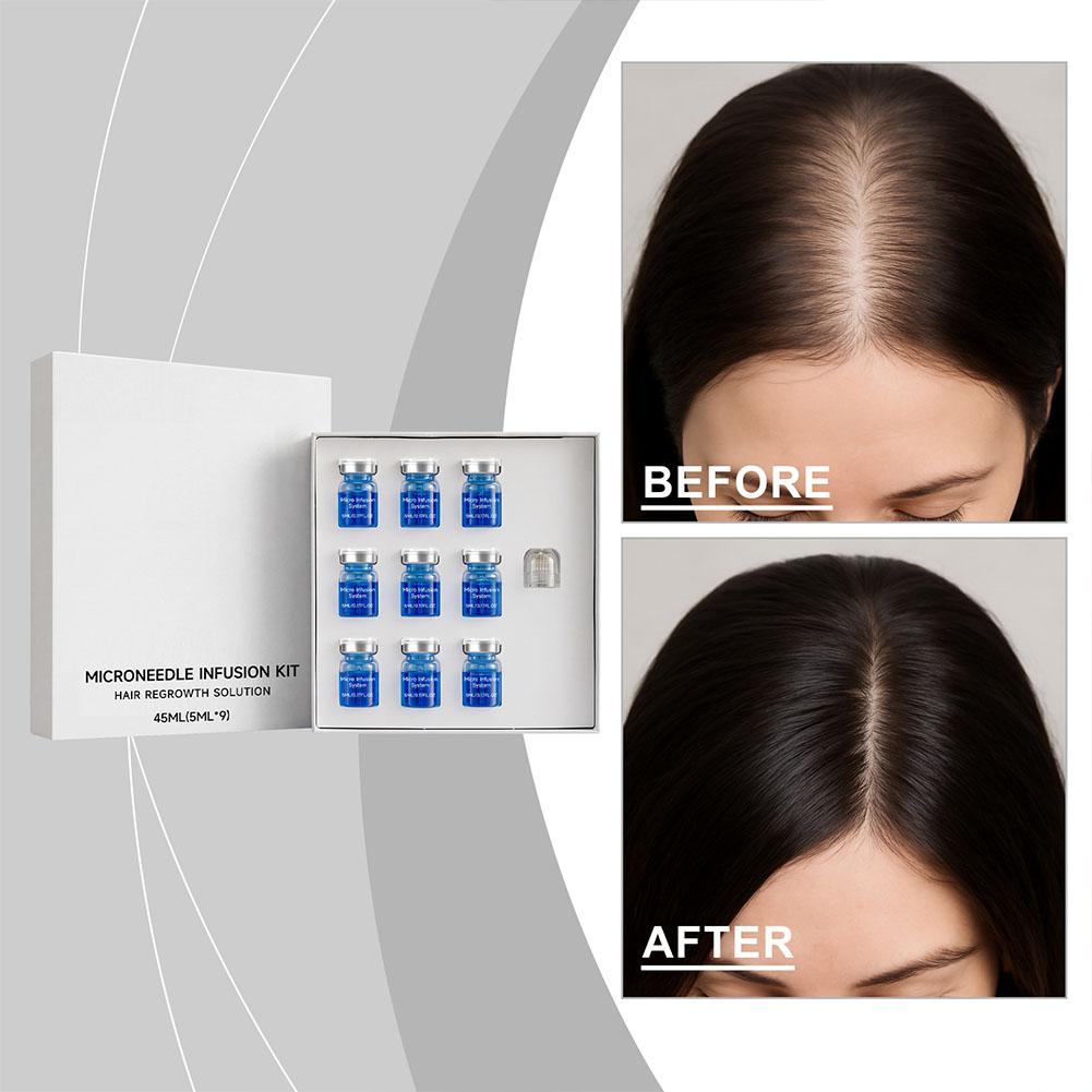 Derma Roller 0.25 - 0.25mm Hair Essential Serum Micro-needle Roller