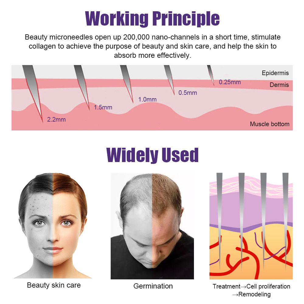 Natural Men Beard Growth Derma - огляд і ціна Derma Roller 0.25