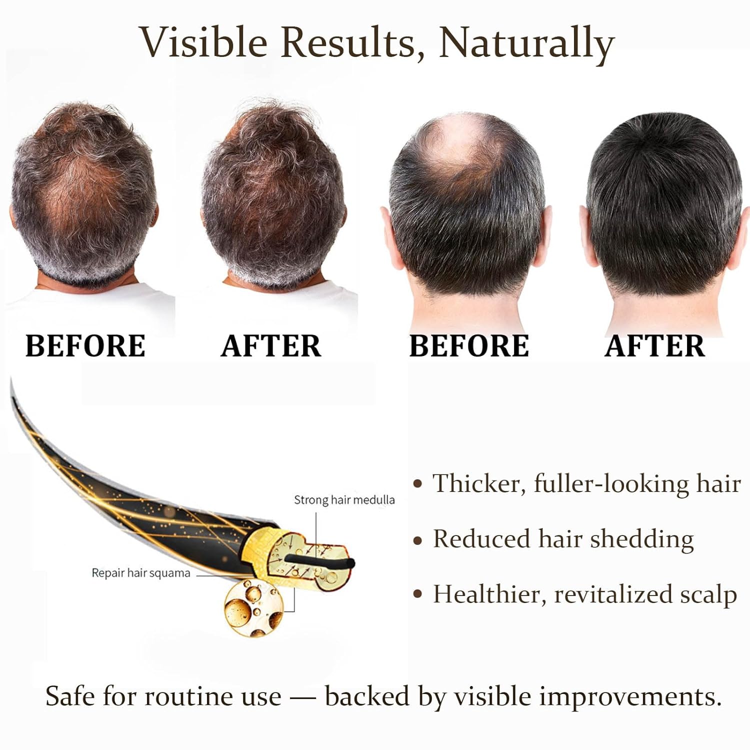 0.25mm Hair Care Micro-needle  - огляд і ціна Derma Roller 0.25